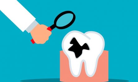 Sognare denti marci : 11 scenari e interpretazioni