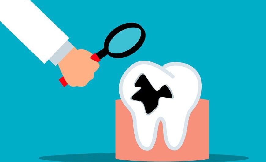 Sognare denti marci : 11 scenari e interpretazioni