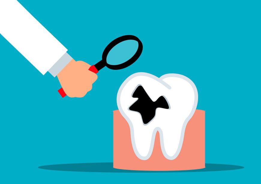 Sognare denti marci : 11 scenari e interpretazioni