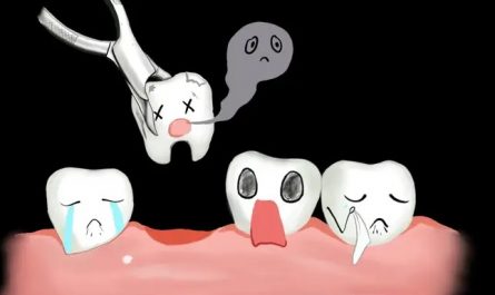 sognato che mi avrebbero estratto un dente dal dentista : 16 scenari e interpretazioni