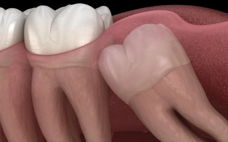 Sognare i denti del giudizio : 16 scenari e interpretazioni