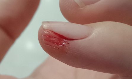 Sognare mani ferite : 22 scenari e interpretazioni