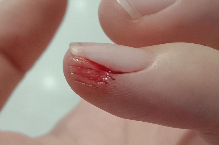 Sognare mani ferite : 22 scenari e interpretazioni