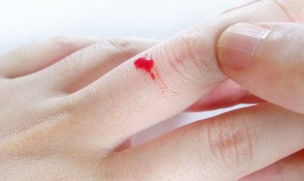 Sognare dita sanguinanti : 18 scenari e interpretazioni