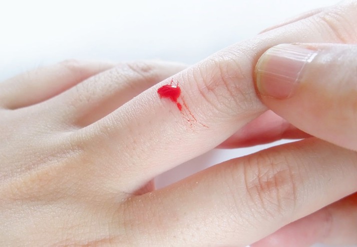 Sognare dita sanguinanti : 18 scenari e interpretazioni