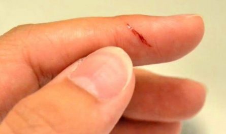 Sognare di tagliarti le dita : 14 scenari e interpretazioni