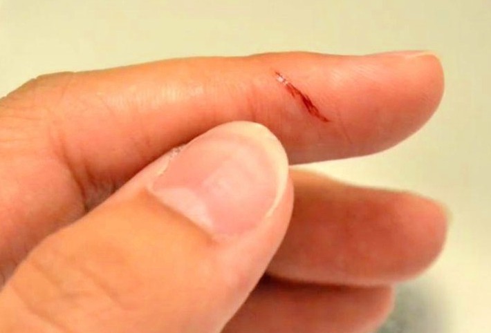 Sognare di tagliarti le dita : 14 scenari e interpretazioni