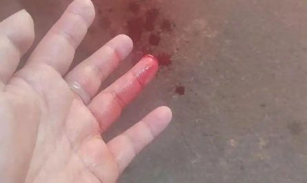 Sognare di farti tagliare le dita : 30 scenari e interpretazioni