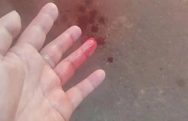 Sognare di farti tagliare le dita : 30 scenari e interpretazioni