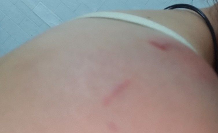 Sognare che tuo marito ti picchia : 11 scenari e interpretazioni