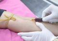 24 Significati Simbolici del Sognare di Donare il Sangue