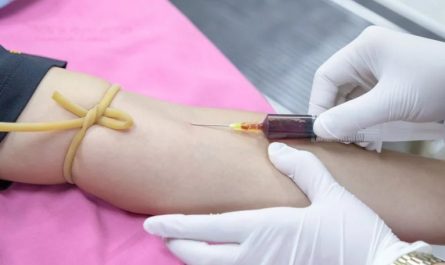 24 Significati Simbolici del Sognare di Donare il Sangue