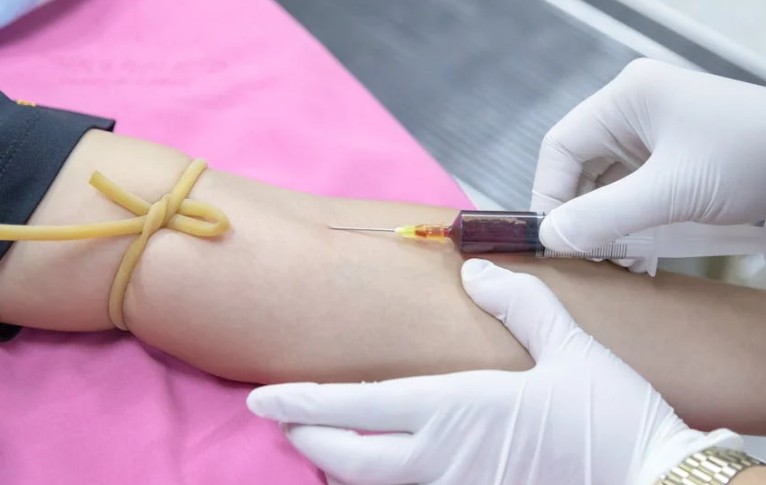 24 Significati Simbolici del Sognare di Donare il Sangue